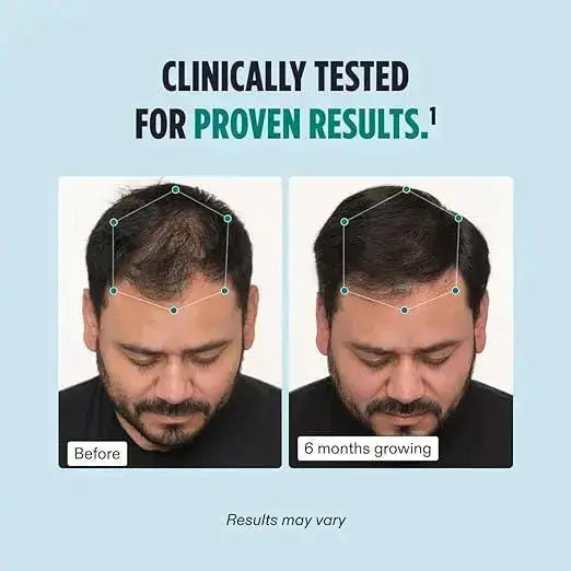 Nutrafol Men Balance Hair Growth Supplement